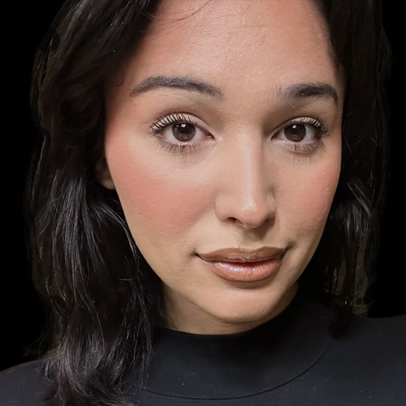 Evolve Your Life facial feminization surgery patient