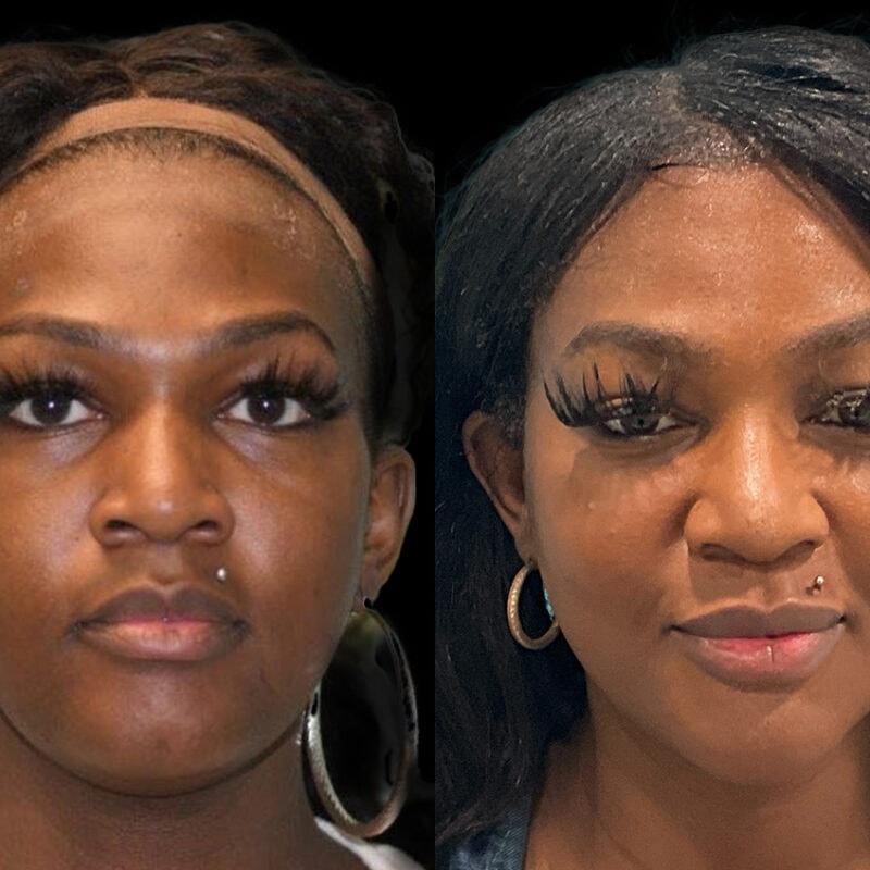 Evolve Your Life before and after gender affirmation