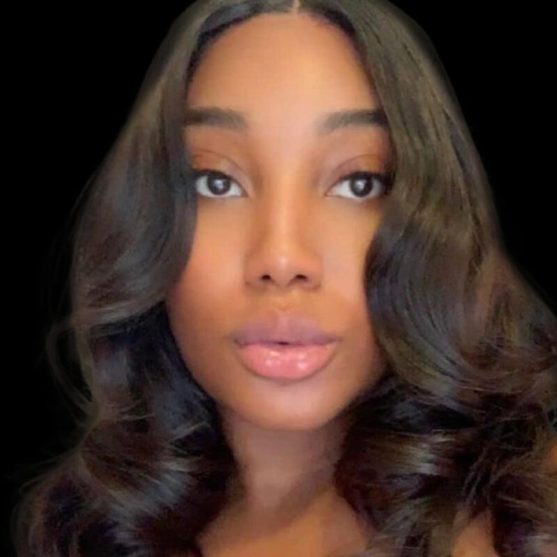 Evolve Your Life facial feminization surgery patient