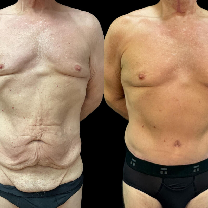 Evolve Your Life before and after daddy do over