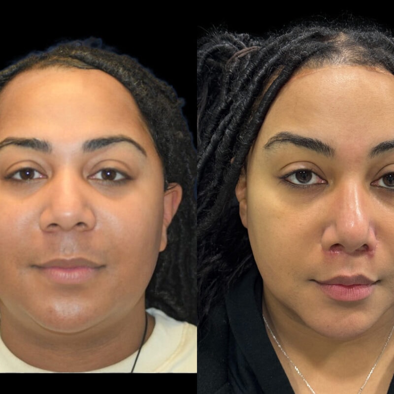 Evolve Your Life before and after gender affirmation