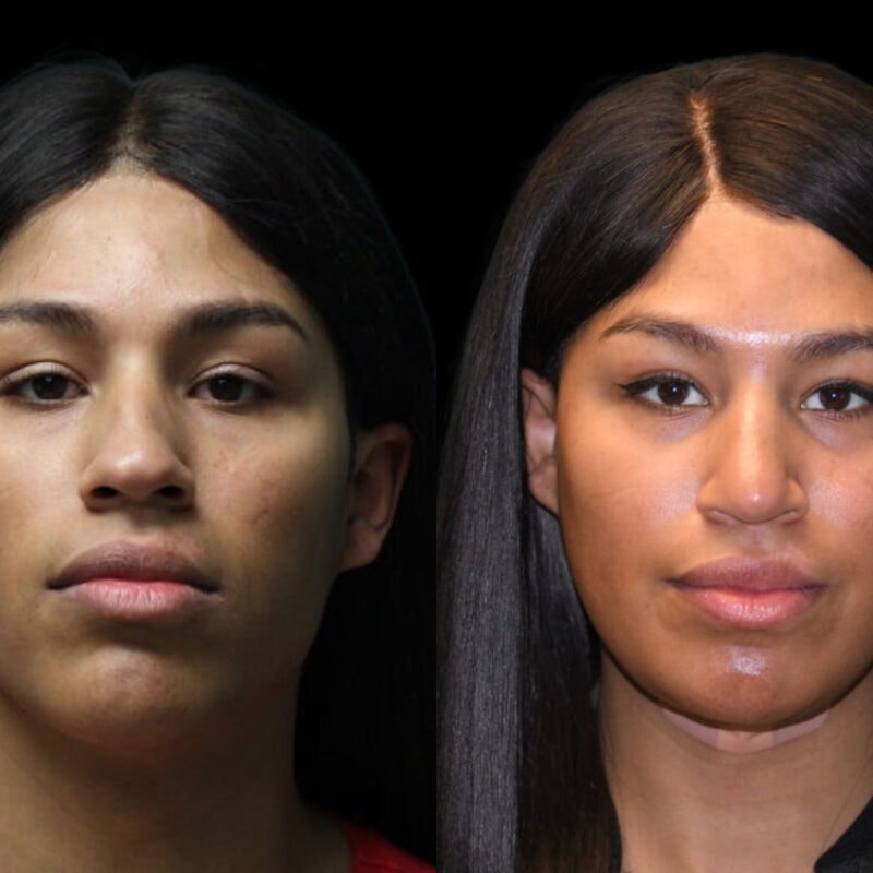 Evolve Your Life before and after gender affirmation