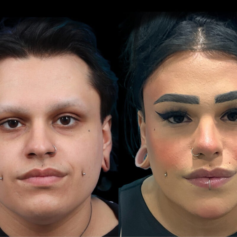 Evolve Your Life before and after gender affirmation